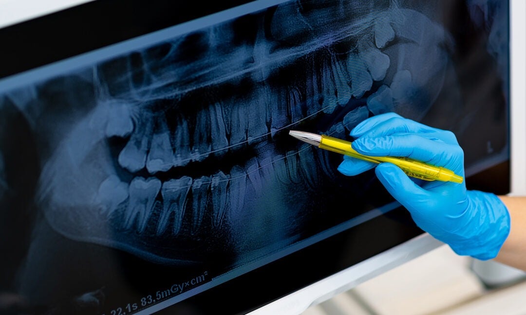 Alpan Orthodontics: Pioneering Smiles with Precision